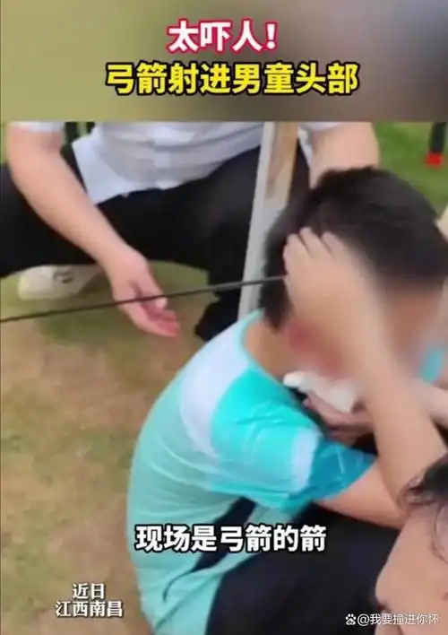 儿子赛场遭重创，齐达内看台摇头叹息，体坛巨星也逃不过育儿焦虑
